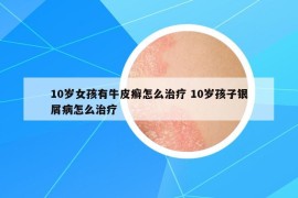 10歲女孩有牛皮癬怎么治療 10歲孩子銀屑病怎么治療