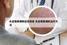 頭皮銀屑病特征性表現(xiàn) 頭皮銀屑病的治療方法