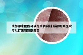 成都哪家醫(yī)院可以打生物制劑 成都哪家醫(yī)院可以打生物制劑疫苗