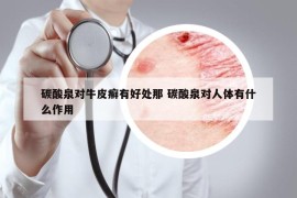 碳酸泉對牛皮癬有好處那 碳酸泉對人體有什么作用