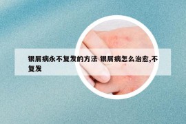 銀屑病永不復(fù)發(fā)的方法 銀屑病怎么治愈,不復(fù)發(fā)
