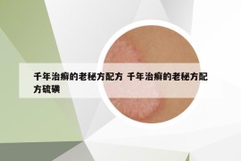 千年治癬的老秘方配方 千年治癬的老秘方配方硫磺