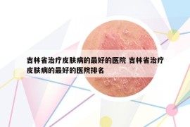 吉林省治療皮膚病的最好的醫(yī)院 吉林省治療皮膚病的最好的醫(yī)院排名