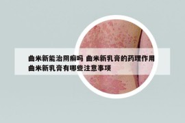 曲米新能治陰癬嗎 曲米新乳膏的藥理作用 曲米新乳膏有哪些注意事項