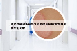 醋和花椒熬治癬多久能去根 醋和花椒熬制癬多久能去根