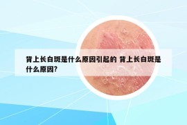 背上長(zhǎng)白斑是什么原因引起的 背上長(zhǎng)白斑是什么原因?