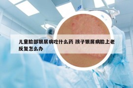 兒童臉部銀屑病吃什么藥 孩子銀屑病臉上老反復(fù)怎么辦