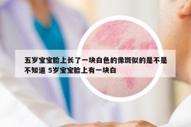 五歲寶寶臉上長了一塊白色的像斑似的是不是不知道 5歲寶寶臉上有一塊白