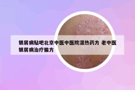 銀屑病貼吧北京中醫(yī)中醫(yī)院濕熱藥方 老中醫(yī)銀屑病治療偏方