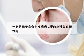 一歲的孩子會有牛皮癬嗎 1歲的小孩會有腳氣嗎