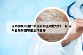 溫州哪里有治療牛皮癬的醫(yī)院比較好一點 溫州看銀屑病哪里治療最好