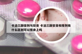 卡泊三醇搽劑與軟膏 卡泊三醇軟膏和擦劑有什么區(qū)別可以擦身上嗎