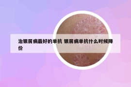 治銀屑病最好的單抗 銀屑病單抗什么時(shí)候降價(jià)