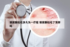 銀屑顆粒吃多久為一療程 銀屑顆粒吃了發(fā)胖嗎