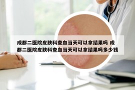 成都二醫(yī)院皮膚科查血當(dāng)天可以拿結(jié)果嗎 成都二醫(yī)院皮膚科查血當(dāng)天可以拿結(jié)果嗎多少錢