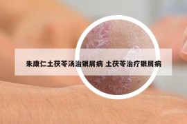 朱康仁土茯苓湯治銀屑病 土茯苓治療銀屑病