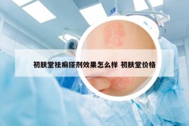 初膚堂祛癬搽劑效果怎么樣 初膚堂價格