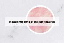 白癬夏塔熱膠囊的用處 白蘚廈塔熱片副作用