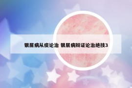 銀屑病從痰論治 銀屑病辯證論治絕技3