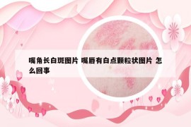 嘴角長白斑圖片 嘴唇有白點顆粒狀圖片 怎么回事