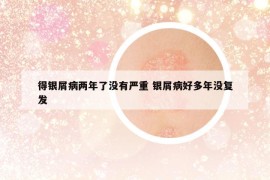 得銀屑病兩年了沒有嚴(yán)重 銀屑病好多年沒復(fù)發(fā)