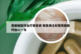 葡糖糖酸鈣治療銀屑病 銀屑病注射葡萄糖酸鈣加vc一年