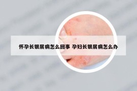 懷孕長銀屑病怎么回事 孕婦長銀屑病怎么辦