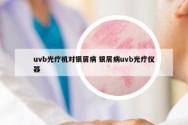 uvb光療機對銀屑病 銀屑病uvb光療儀器
