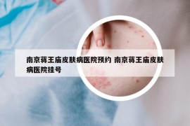南京蔣王廟皮膚病醫(yī)院預約 南京蔣王廟皮膚病醫(yī)院掛號