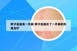 脖子后面有一片蘚 脖子后面長了一片癬的東西治療