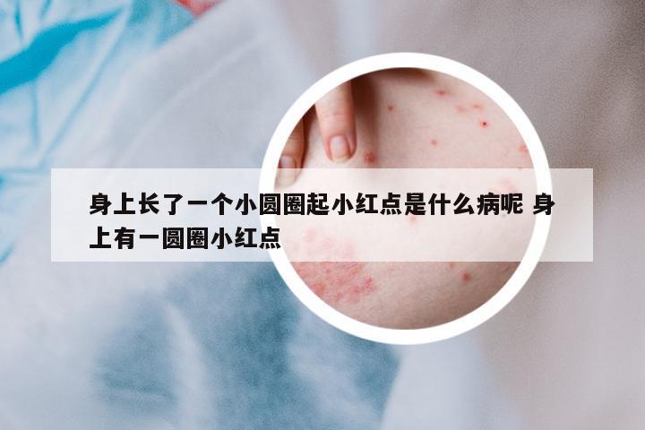 身上長了一個小圓圈起小紅點是什么病呢 身上有一圓圈小紅點
