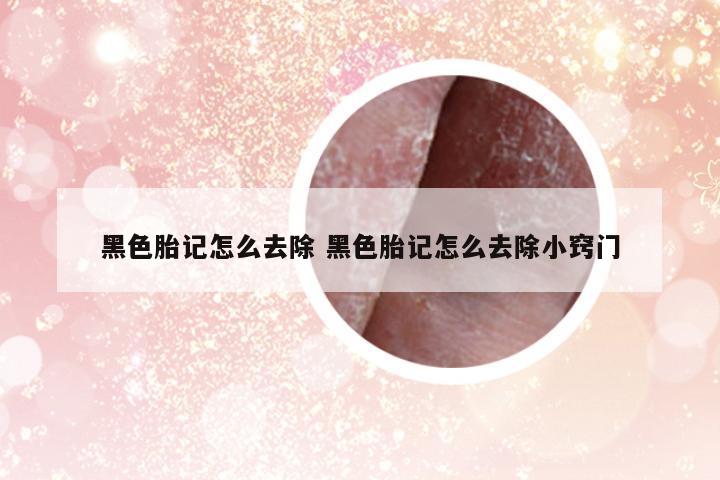 黑色胎記怎么去除 黑色胎記怎么去除小竅門