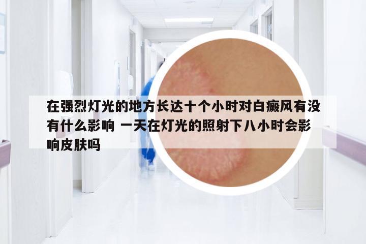 在強(qiáng)烈燈光的地方長(zhǎng)達(dá)十個(gè)小時(shí)對(duì)白癜風(fēng)有沒(méi)有什么影響 一天在燈光的照射下八小時(shí)會(huì)影響皮膚嗎