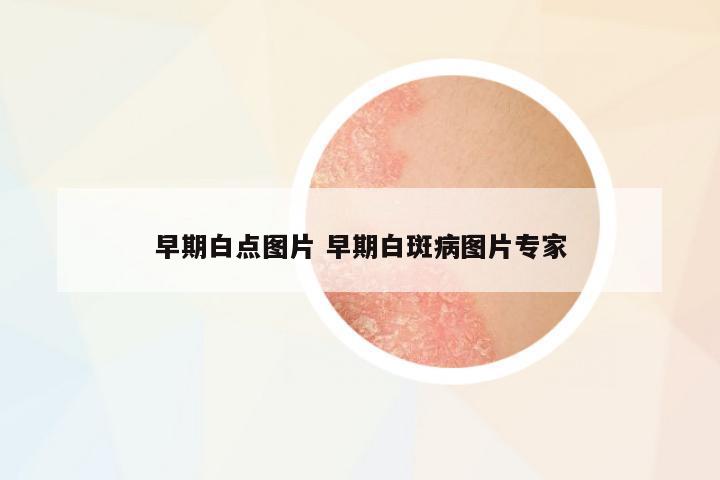 早期白點(diǎn)圖片 早期白斑病圖片專家