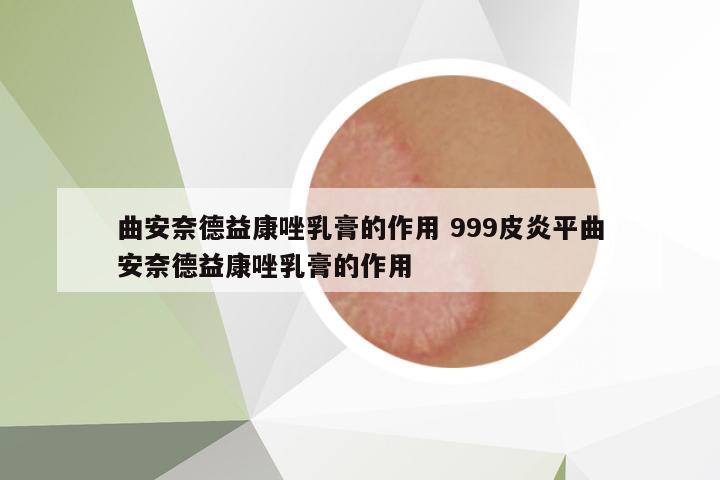 曲安奈德益康唑乳膏的作用 999皮炎平曲安奈德益康唑乳膏的作用