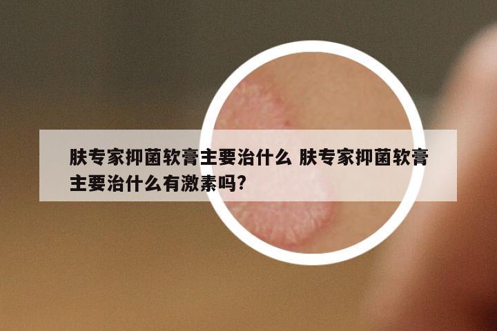 膚專家抑菌軟膏主要治什么 膚專家抑菌軟膏主要治什么有激素嗎?
