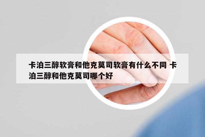 卡泊三醇軟膏和他克莫司軟膏有什么不同 卡泊三醇和他克莫司哪個(gè)好