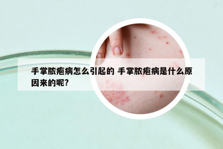 手掌膿皰病怎么引起的 手掌膿皰病是什么原因來的呢?