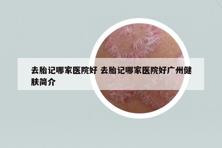 去胎記哪家醫(yī)院好 去胎記哪家醫(yī)院好廣州健膚簡介