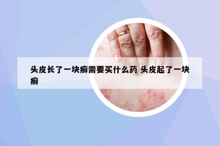 頭皮長了一塊癬需要買什么藥 頭皮起了一塊癬