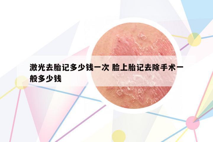 激光去胎記多少錢一次 臉上胎記去除手術(shù)一般多少錢