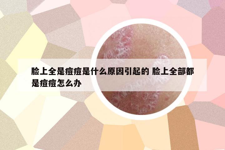 臉上全是痘痘是什么原因引起的 臉上全部都是痘痘怎么辦