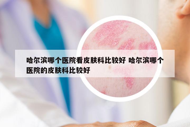 哈爾濱哪個醫(yī)院看皮膚科比較好 哈爾濱哪個醫(yī)院的皮膚科比較好
