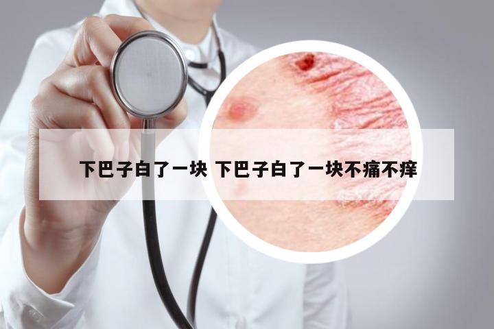 下巴子白了一塊 下巴子白了一塊不痛不癢