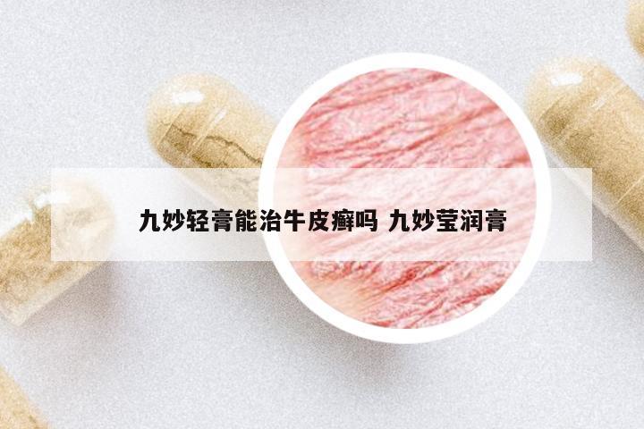 九妙輕膏能治牛皮癬嗎 九妙瑩潤膏
