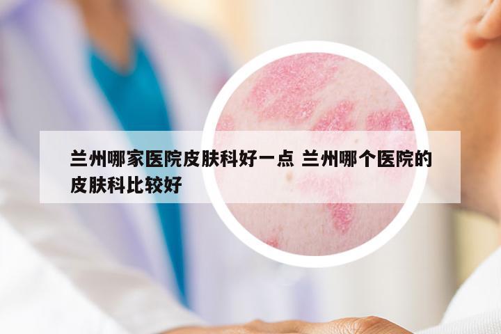 蘭州哪家醫(yī)院皮膚科好一點 蘭州哪個醫(yī)院的皮膚科比較好