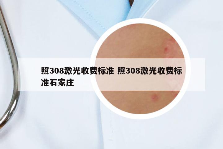 照308激光收費(fèi)標(biāo)準(zhǔn) 照308激光收費(fèi)標(biāo)準(zhǔn)石家莊