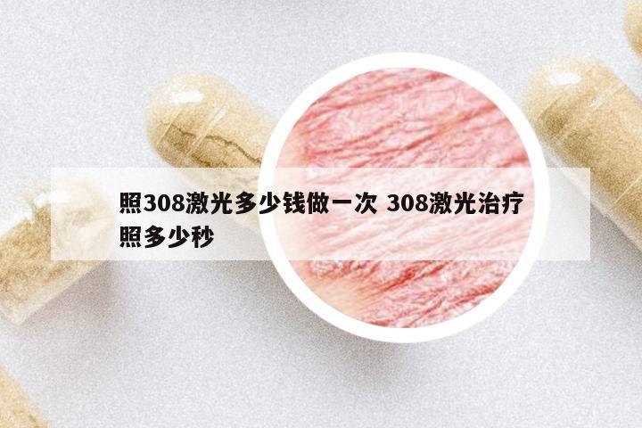 照308激光多少錢(qián)做一次 308激光治療照多少秒