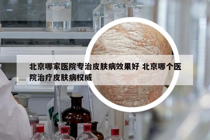 北京哪家醫(yī)院專治皮膚病效果好 北京哪個醫(yī)院治療皮膚病權(quán)威