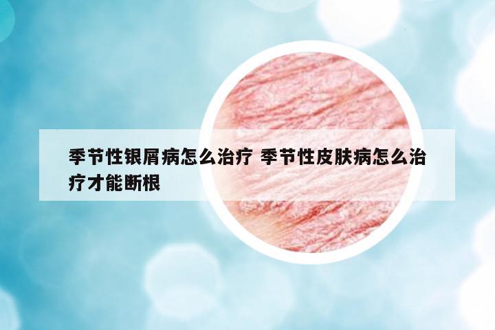 季節(jié)性銀屑病怎么治療 季節(jié)性皮膚病怎么治療才能斷根